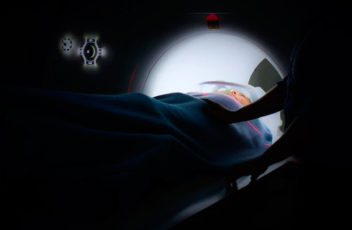 cancer-treatments